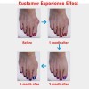 1 paar Silikon Fußpflege Hallux Valgus Corrector