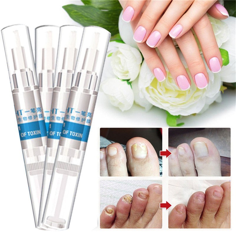 Hand- und Fußnagelpflegestift