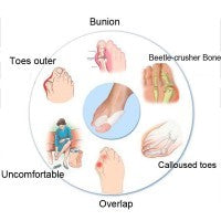 1 paar Silikon Fußpflege Hallux Valgus Corrector