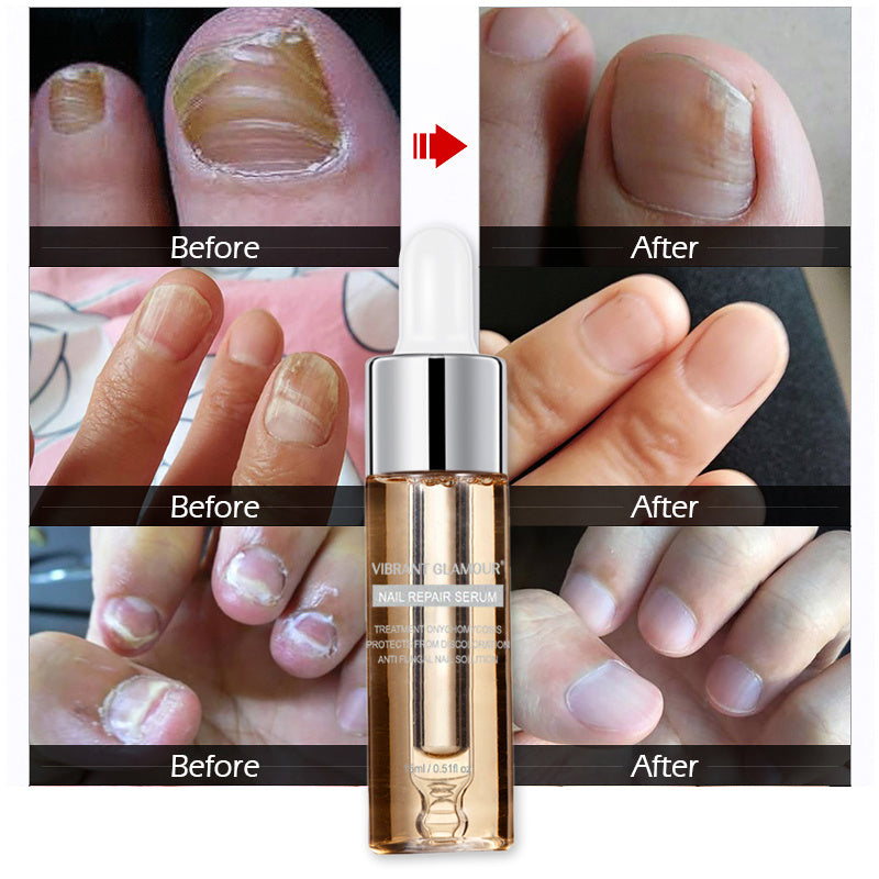Nagelreparatur- und Pflegeflüssigkeit