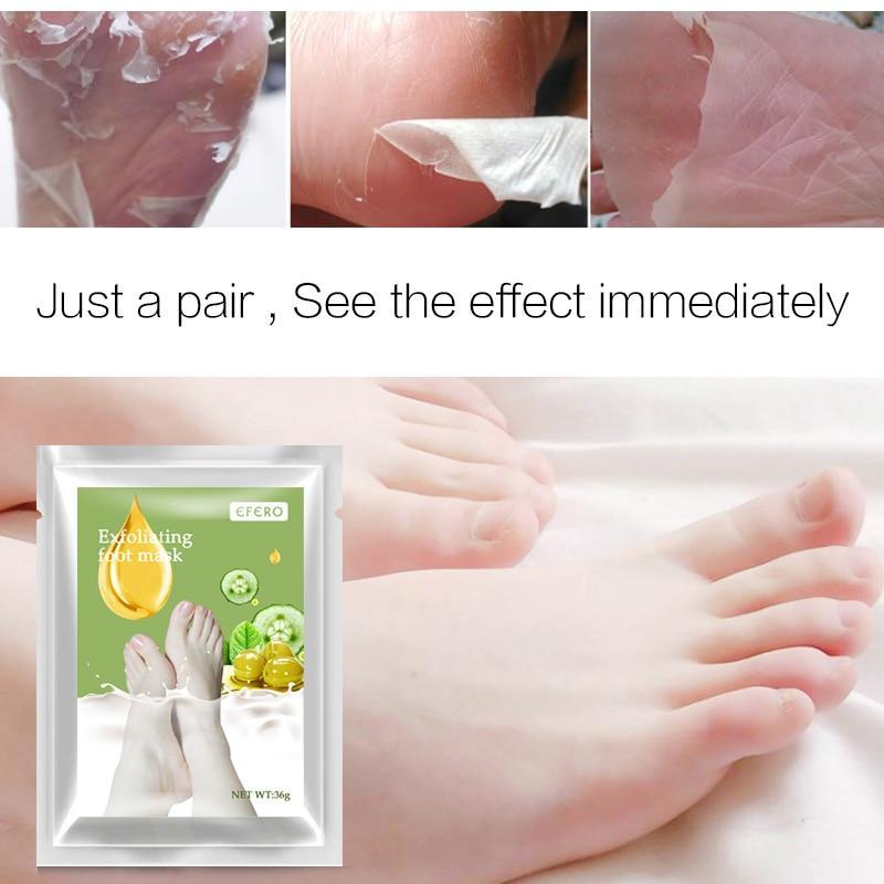 Aloe Vera Fuß Maske Peeling Für Beine Füße Maske Peeling Socken Peeling Für Pediküre Anti Riss Ferse Entfernen Haut Fuß patch