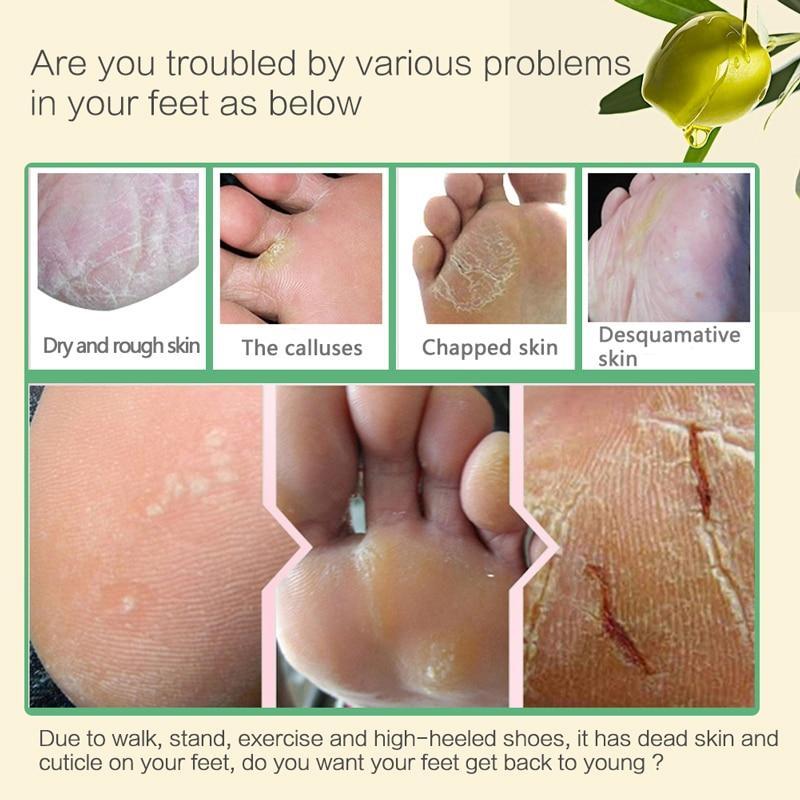 Aloe Vera Fuß Maske Peeling Für Beine Füße Maske Peeling Socken Peeling Für Pediküre Anti Riss Ferse Entfernen Haut Fuß patch