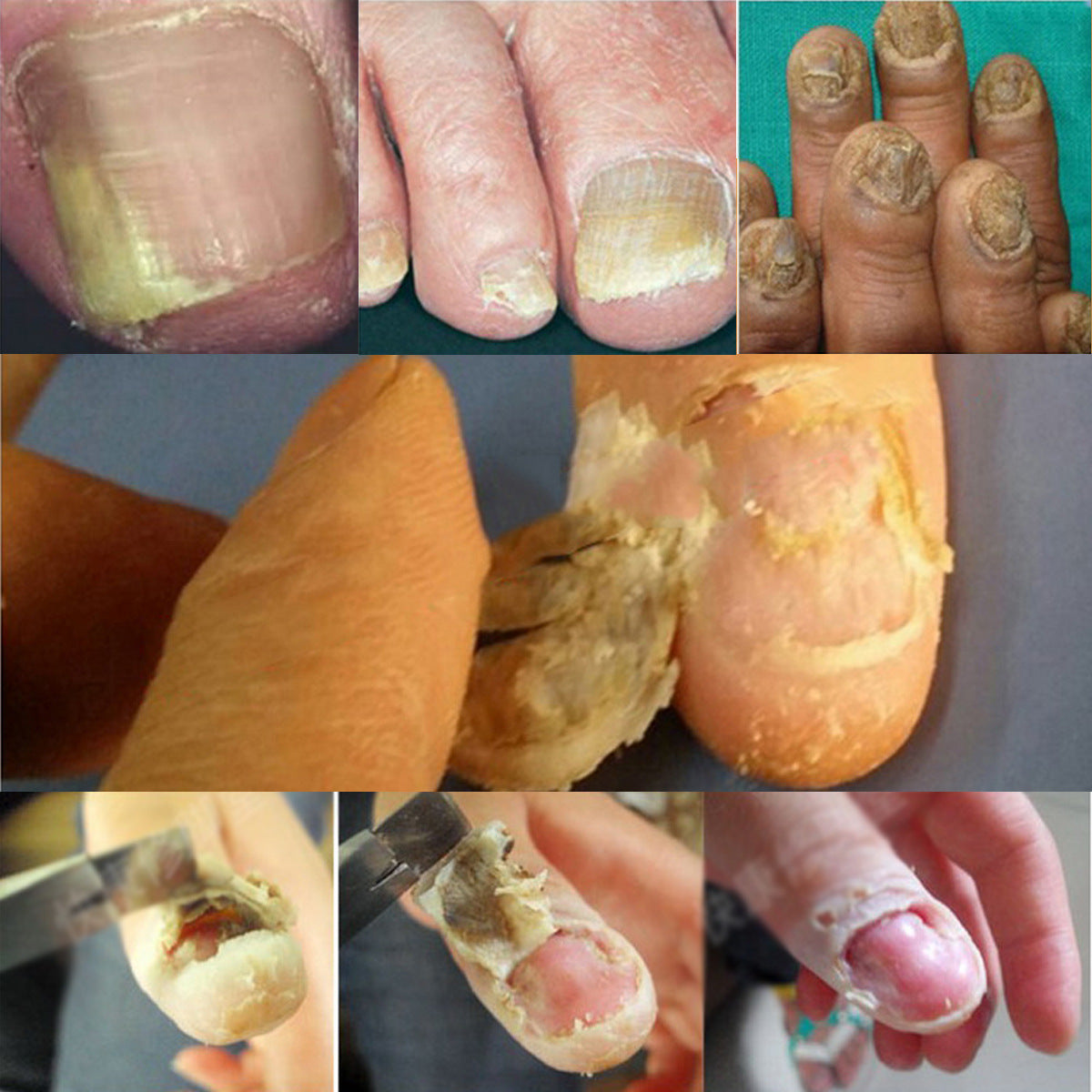 Graues Nagelentferner-Pediküre-Werkzeug