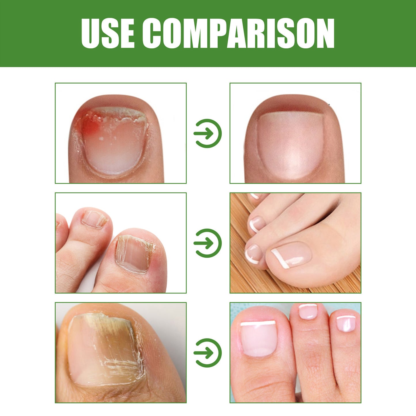 Ballmassage Feuchtigkeitsspendende Nagelpflege