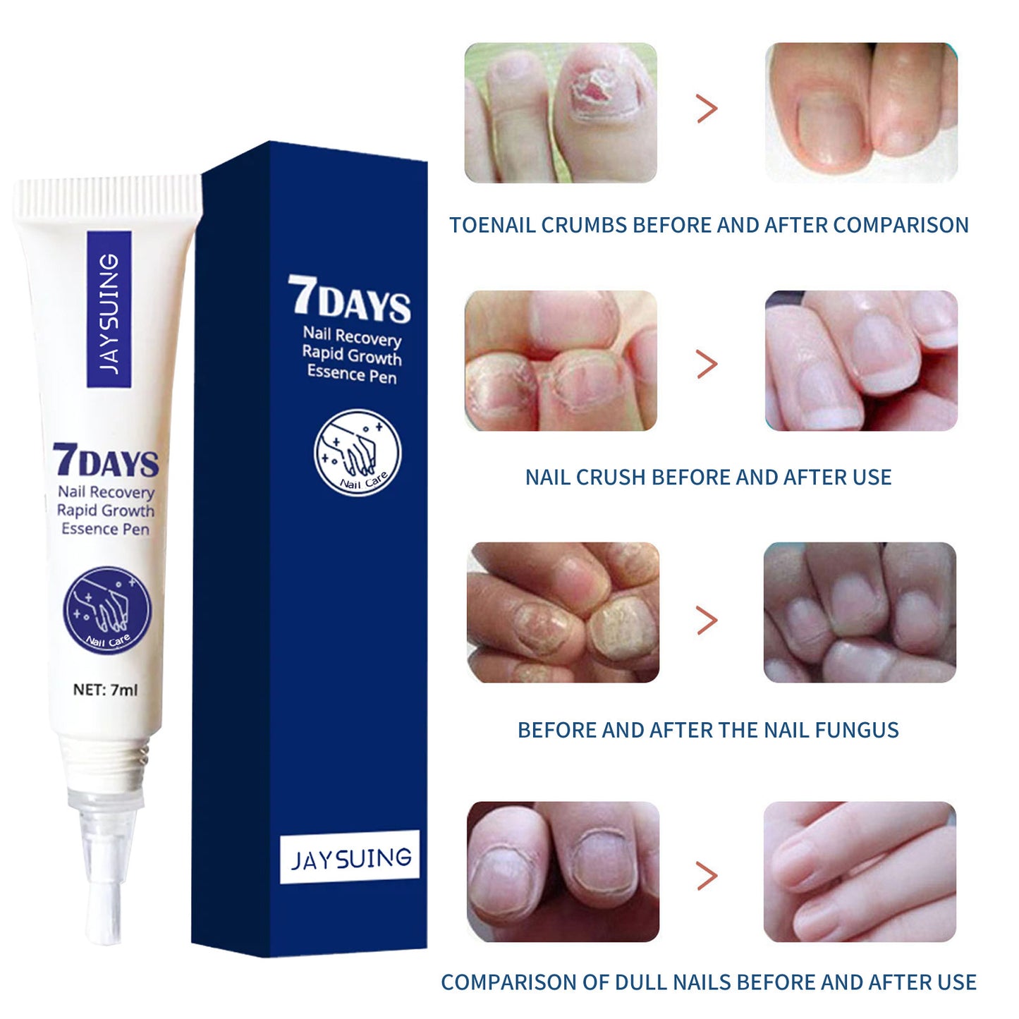 Hand- und Fußnagelpflegelösung