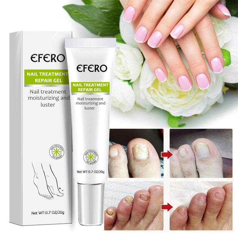 Nail Gel Nail Liquid Plant Nail Liquid