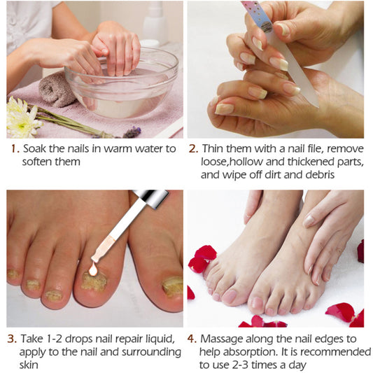 Nagelreparatur- und Pflegeflüssigkeit