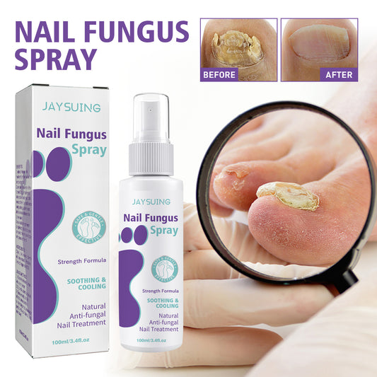 Nagel reparatur Spray Reinigungs pflege