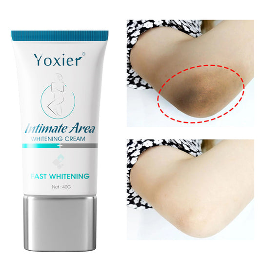 Aufhellende Creme für den Intimbereich, zur Aufhellung, Reparatur von Achselhöhlen, Ellenbogen und Gesäß, feuchtigkeitsspendend, nährend, Nicotinamid, Körperpflege