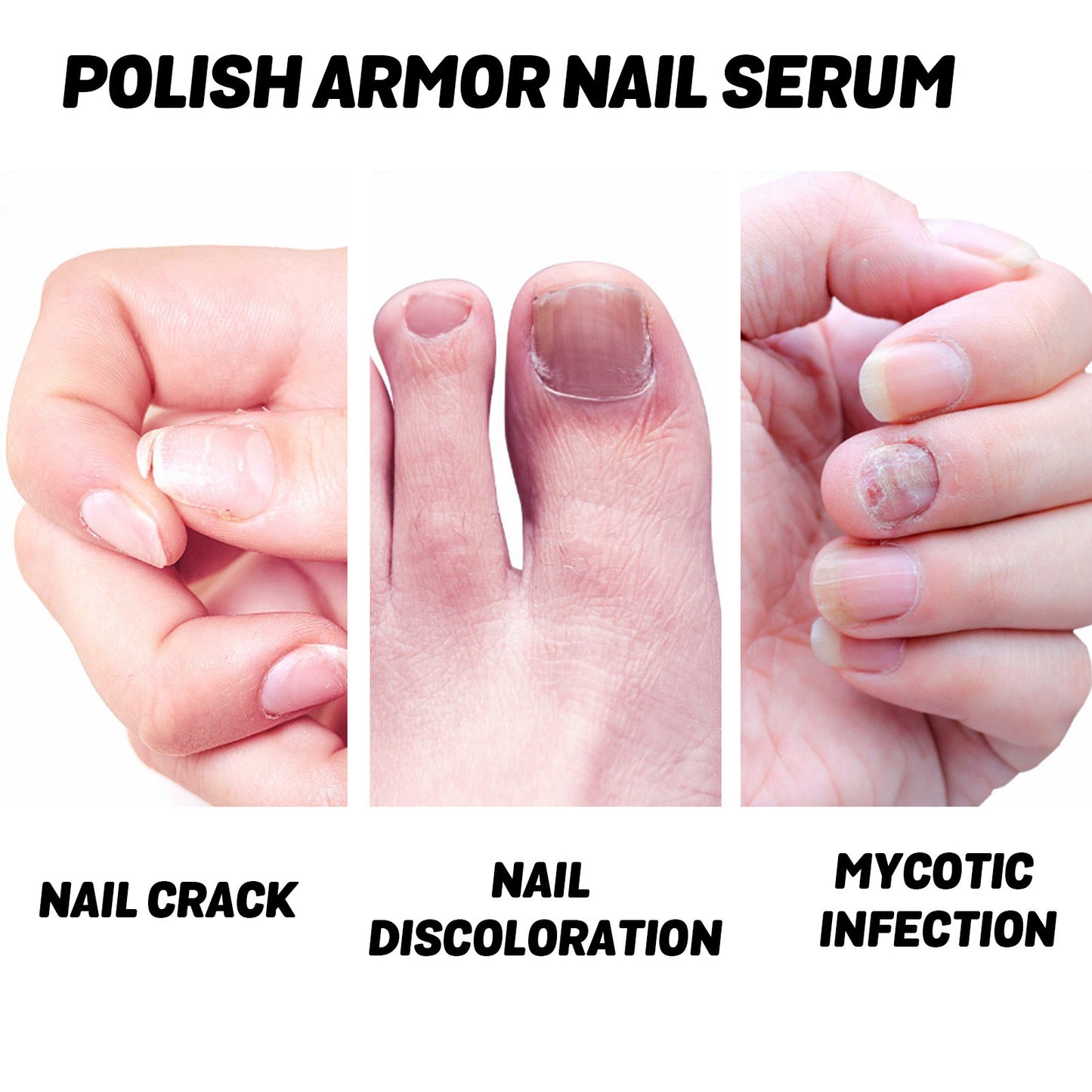 Pflegender Nagelschoner Beauty