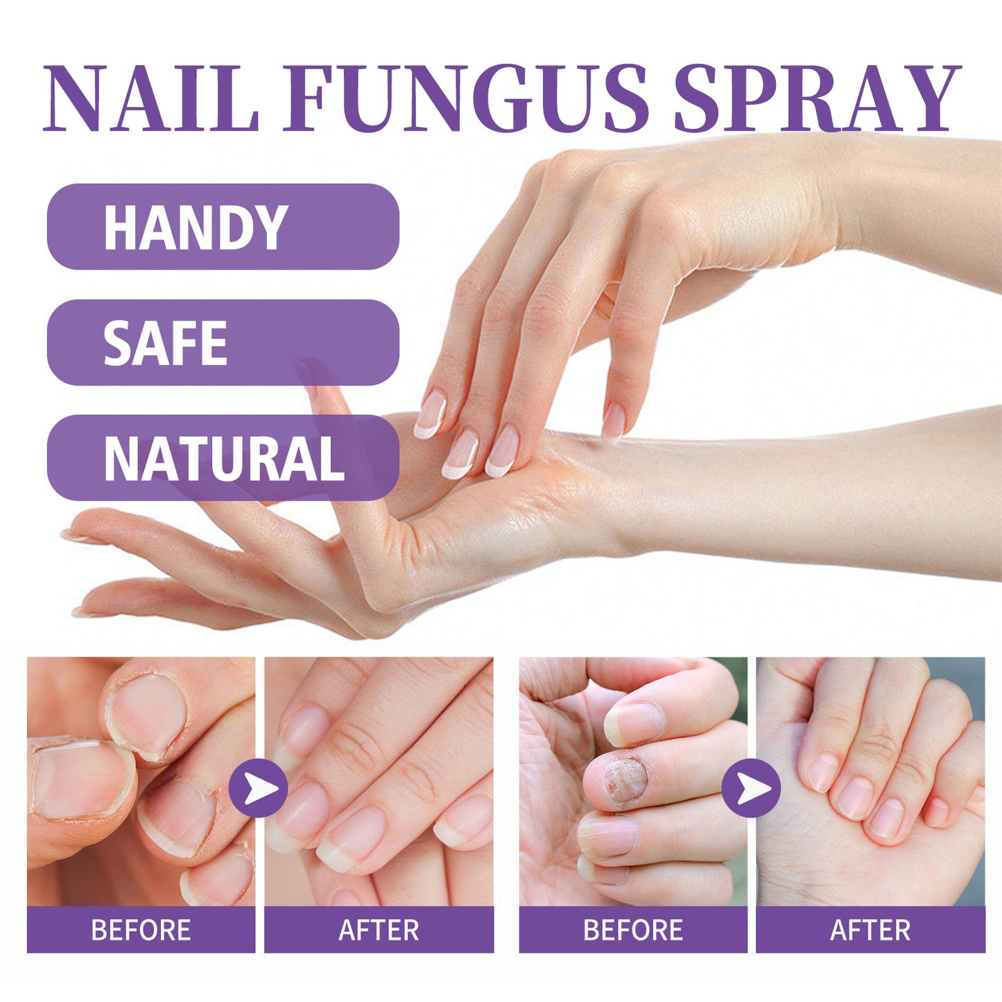 Nagel reparatur Spray Reinigungs pflege