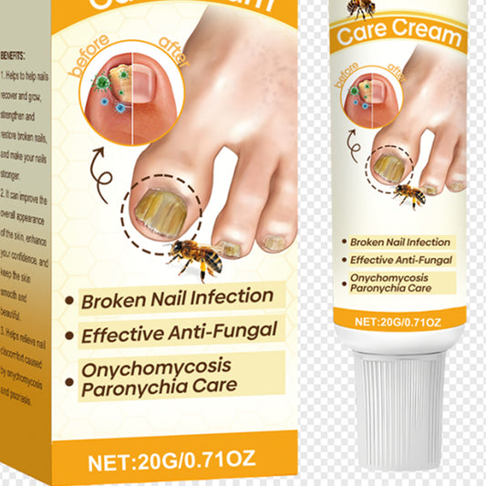 Psoriasis-Pflegecreme für graue Nägel
