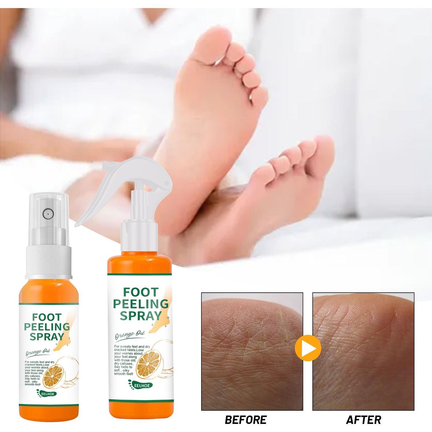 Peeling Füße Entfernen Abgestorbene Haut Und Schwielen Ferse Ellenbogen Und Knie Pflege Spray