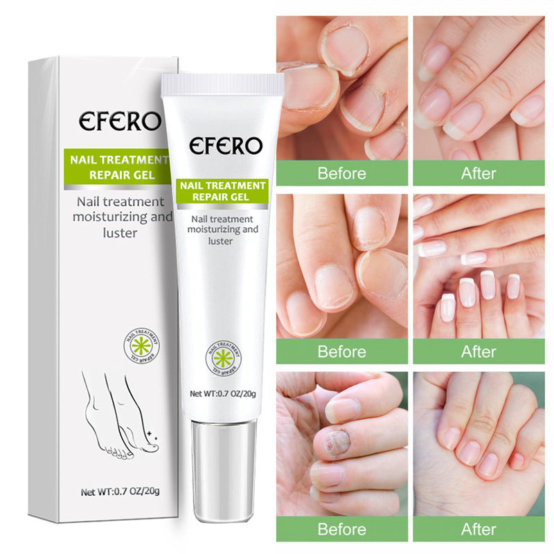 Nail Gel Nail Liquid Plant Nail Liquid